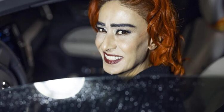 Yıldız Tilbe'nin yüzü yandı