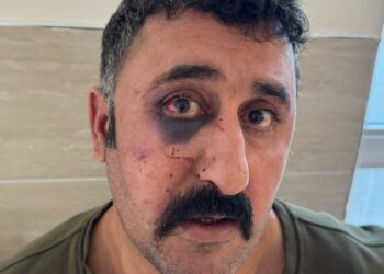 İşkence uygulayan polis, belgeleyen avukatı da darp etti!