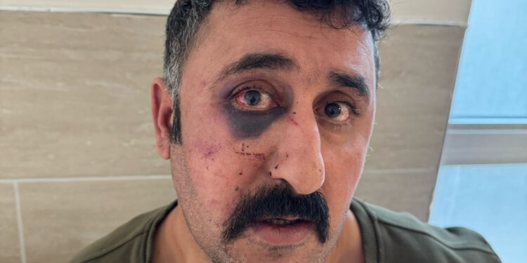 İşkence uygulayan polis, belgeleyen avukatı da darp etti!