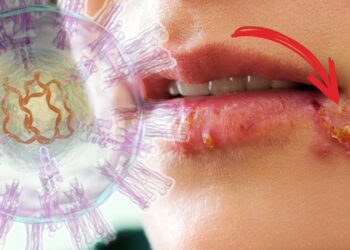 Aman Dikkat! Çene Kemiğini Bile Eritebilir