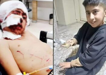 Erzurum’da bakkala giderken köpeklerin saldırısına uğrayan çocuk yaralandı