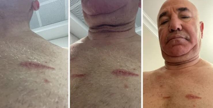 Tanal: Bu yaralar sadece bedende değil, hukuk devletinde açılmıştır