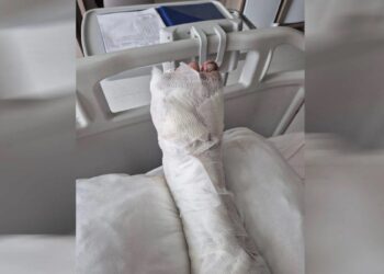 TOMA’nın ayağını ezdiği genç 2 ay yürüyemeyecek