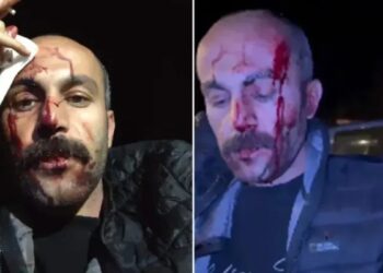 Türkiye Barolar Birliği’nden polis şiddetine tepki