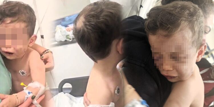 Kan Donduran Vahşet! 2 Yaşındaki Bebek, Annesinin Sevgilisi Tarafından Öldüresiye Dövüldü