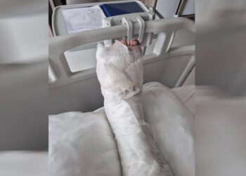 Öğrencinin ayağını TOMA ezdiği iddia edilmişti: Ankara Barosu devreye girdi