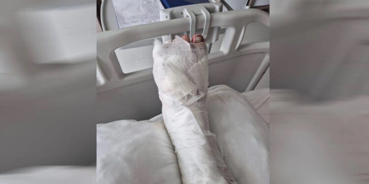 Öğrencinin ayağını TOMA ezdiği iddia edilmişti: Ankara Barosu devreye girdi