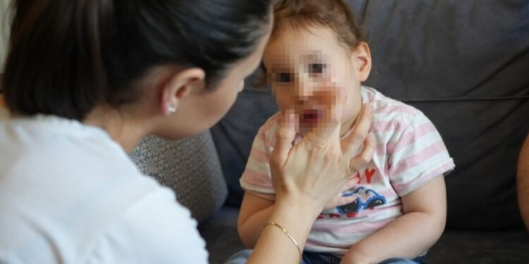 Özel Kreşte Bebeğe Darp: Aile ve Sosyal Hizmetler Bakanlığı Harekete Geçti