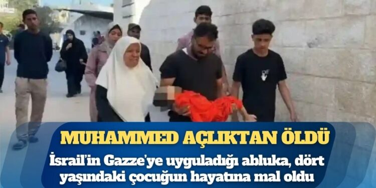 Gazze’de 4 yaşındaki Muhammed açlıktan öldü