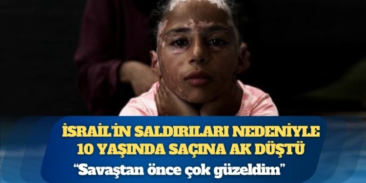 İsrail’in saldırıları nedeniyle saçlarına ak düşen Filistinli kız eski günlerine dönmek istiyor: “Savaştan önce çok güzeldim”