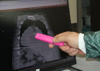 Karadeniz'den Dünyaya Yeni Bir Sendrom