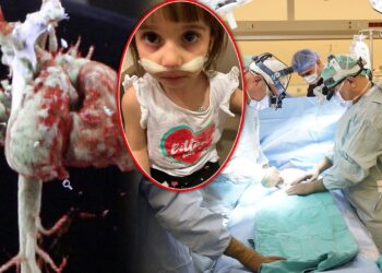 Yatay Kalple Doğan Fatma Nur Tıp Literatürüne Girecek! Türkiye'de Tek, Dünyada İkinci...