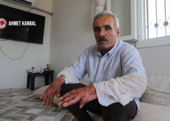 Yangın felaketinin 1’nci yılı: Yaralılar yaşam, aileler adalet mücadelesinde