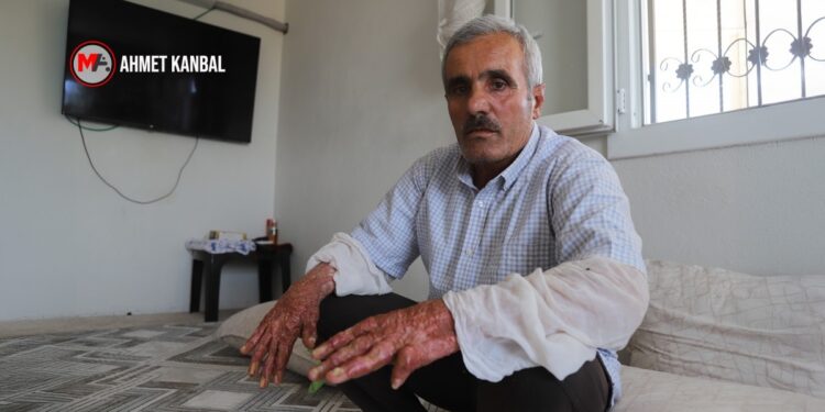 Yangın felaketinin 1’nci yılı: Yaralılar yaşam, aileler adalet mücadelesinde