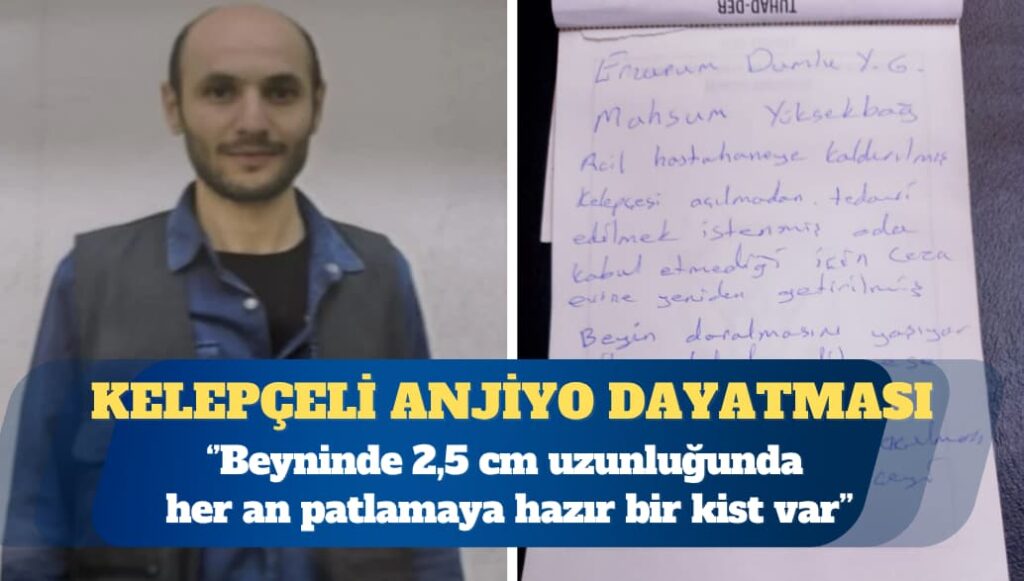 Hasta mahpusa kelepçeli anjiyo dayatması: Beyninde 2,5 cm uzunluğunda her an patlamaya hazır bir kist var