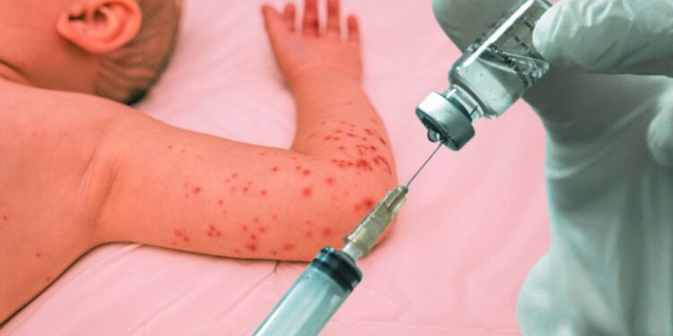 Ürküten Aşı Karşıtlığı Araştırması: O Hastalıklar Yeniden Hortladı! Milyonlarca Çocuk Tehlikede