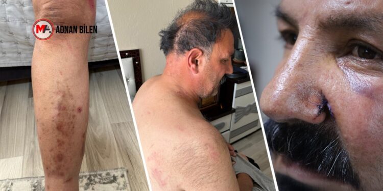 Ev baskınında polis şiddeti ve ölüm tehdidi