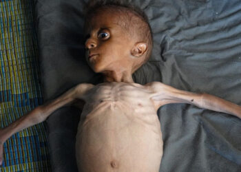 Minik Muhammed Gazze’deki Felaketin Simgesi Oldu! Dünya Gördü, İsrail İnkar Etti