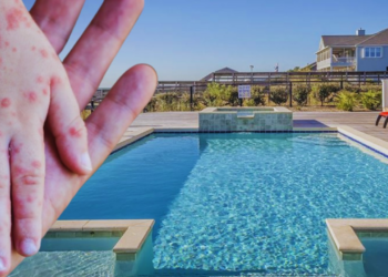 Sessiz Tehlike Havuzda! Çocukları Menenjite Kadar Götüren Virüse Dikkat