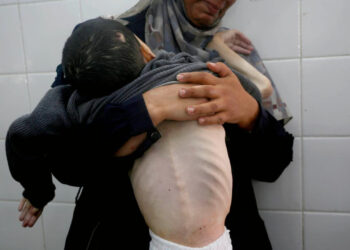 Gazze Açlıktan Ölüyor! Son 24 Saatte 5 Kişi Daha...