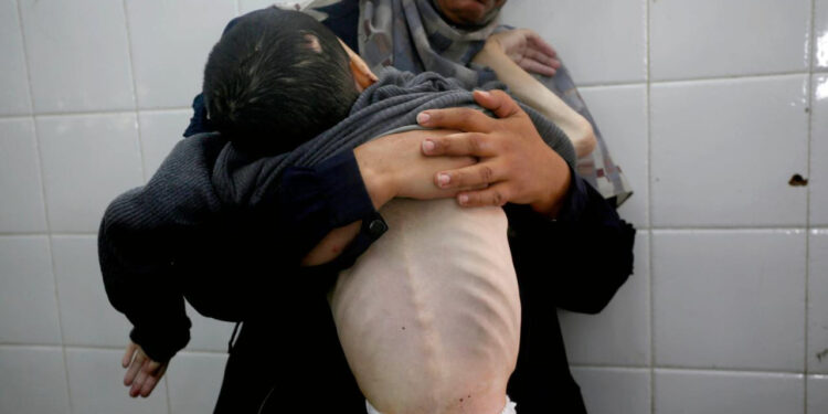 Gazze Açlıktan Ölüyor! Son 24 Saatte 5 Kişi Daha...