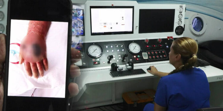 Hırsızın Isırdığı Eli Amputasyondan Döndü! Nadir Görülen Vaka Literatüre Giriyor