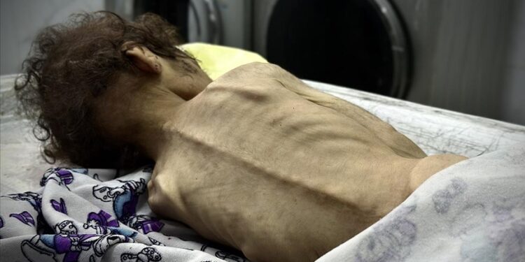 İsrail’in kıtlığı dayattığı Gazze Şeridi’nde son 24 saatte 2’si çocuk 4 kişi daha açlıktan hayatını kaybetti