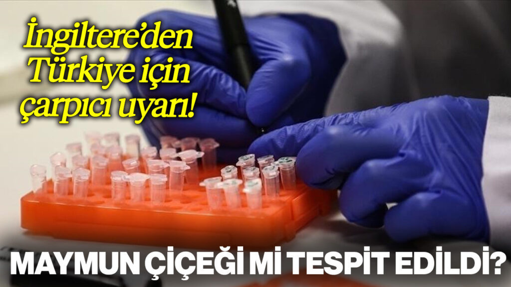 Türkiye'de Maymun Çiçeği mi Tespit Edildi?