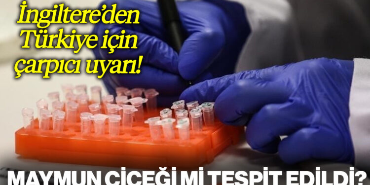 Türkiye'de Maymun Çiçeği mi Tespit Edildi?