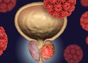 50 Yaş Üstü Erkeklere Hayati Uyarı: ‘Sakın İhmal Etmeyin’