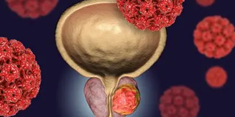 50 Yaş Üstü Erkeklere Hayati Uyarı: ‘Sakın İhmal Etmeyin’