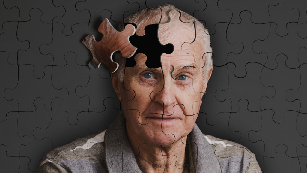 Alzheimer’da Umut Veren İlaçlar Devrede! ‘Kesin Tedavi Henüz Yok Ama Yol Alınıyor’