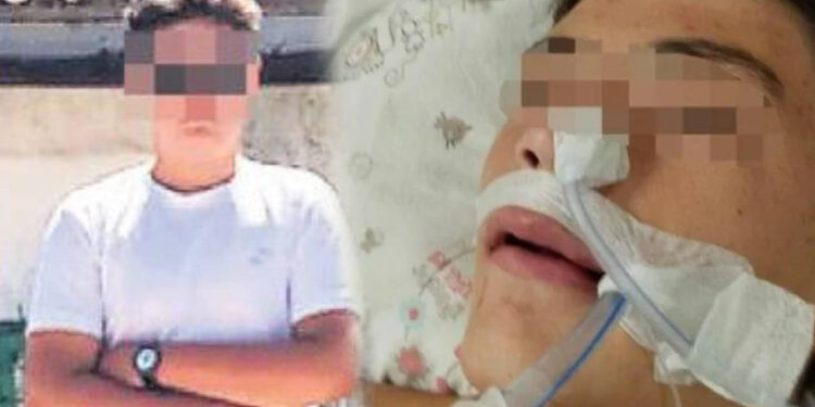 Çanakkale'de Akran Zorbalığı: Ayağına Bastı Diye Sınıf Arkadaşını Öldüresiye Darbetti