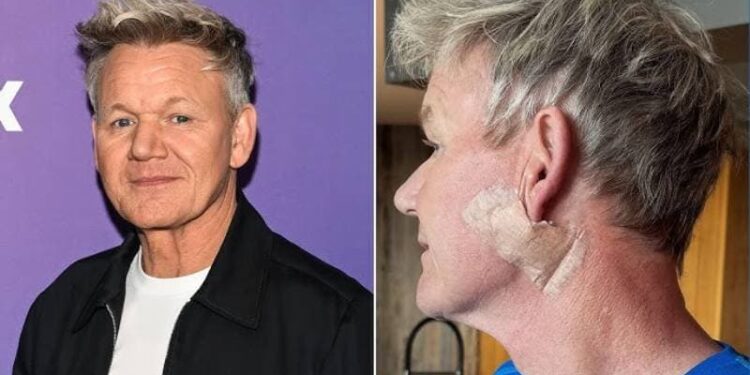 Dünyaca ünlü şef Gordon Ramsay hastalığını ilk kez açıkladı