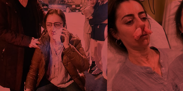 Eşinin Sevgilisi Sandığı Kadını Öldüresiye Dövmüştü! İstenen Ceza Belli Oldu