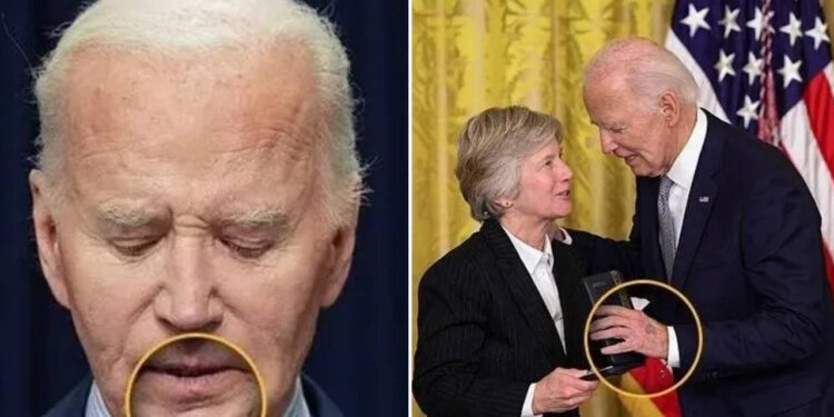 Eski ABD Başkanına Bir Kanser Teşhisi Daha! Gizlice Ameliyata Alındı