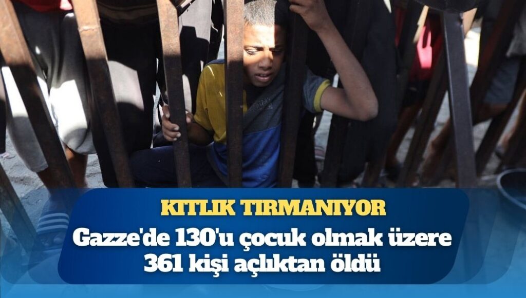 Gazze’de 130’u çocuk olmak üzere 361 kişi açlıktan öldü