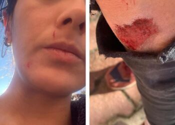 Gazeteci Ezgi Soysal’a saldırı: Ölebilirdim