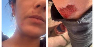 Gazeteci Ezgi Soysal’a saldırı: Ölebilirdim