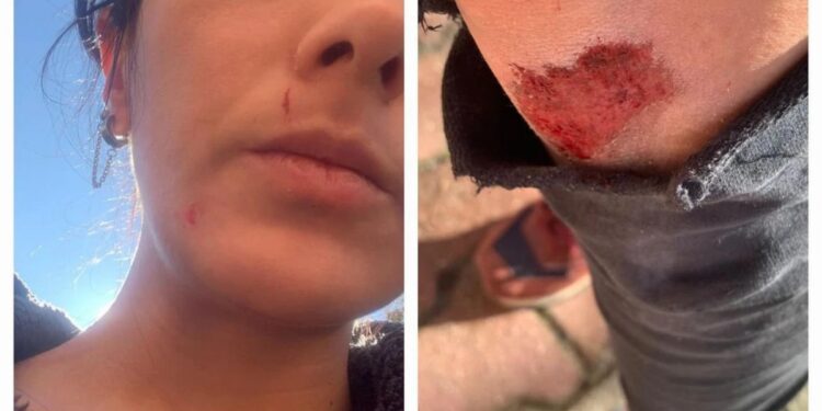 Gazeteci Ezgi Soysal’a saldırı: Ölebilirdim