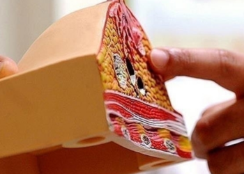 Akciğer Kanserinden Sonra En Yaygın Olan Türe Dikkat! Az da Olsa Erkeklerde de Görülüyor