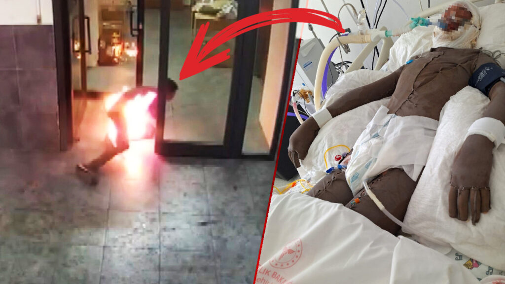 Dehşete Düşüren Görüntüler! '16 Yaşındaki Çocuk, 15 Yaşındaki Arkadaşını Benzinle Yaktı' İddiası