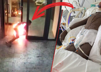 Dehşete Düşüren Görüntüler! '16 Yaşındaki Çocuk, 15 Yaşındaki Arkadaşını Benzinle Yaktı' İddiası