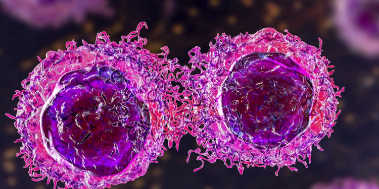 Her 7 Erkekten 1'inde Var! İşte En Sık Görülen İkinci Kanser Türü