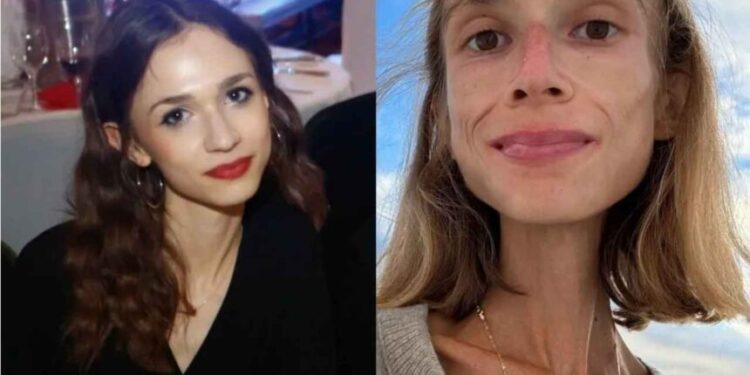 Meyve diyeti fenomenin sonu oldu