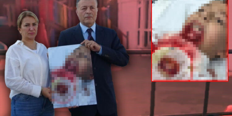 Okulda Demir Çit Faciası! Küçük Kuzey'in Çenesi Koptu