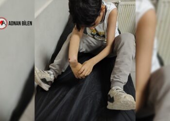 10 yaşındaki E.T.’nin kolunu kıran uzman çavuş hakkında iddianame