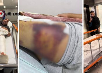 Silahlı saldırıda 4 kişiyi yaralayan korucular serbest bırakıldı