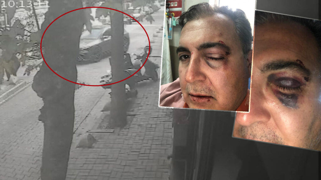 İstanbul'un Göbeğinde Dehşete Düşüren Anlar! Sokak Kedilerini Besleyen İş İnsanına Yumruklu Saldırı