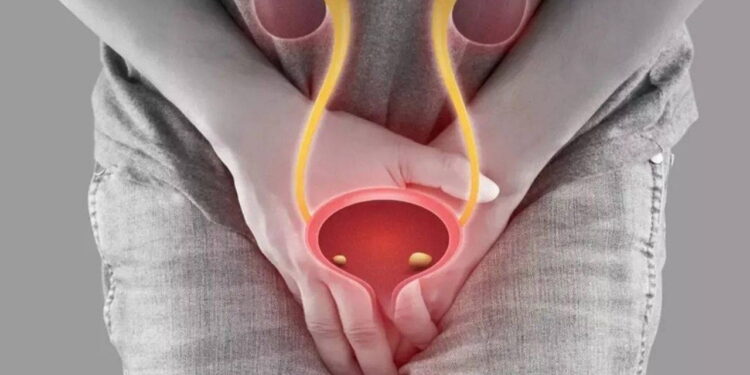 Uzmanlar açıkladı: Renk körlüğü mesane kanserinde ölüm riskini artırabilir